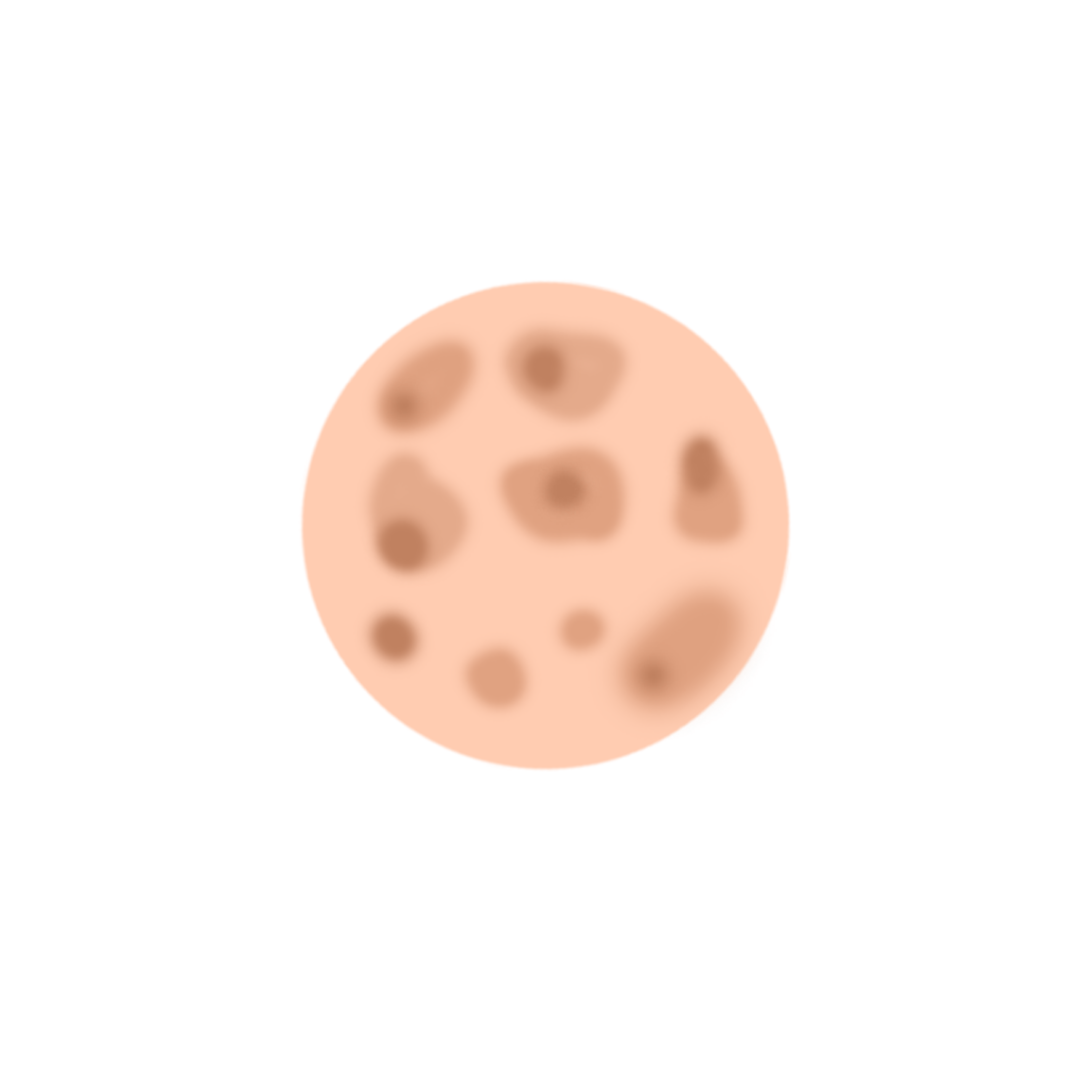 Hyperpigmentation