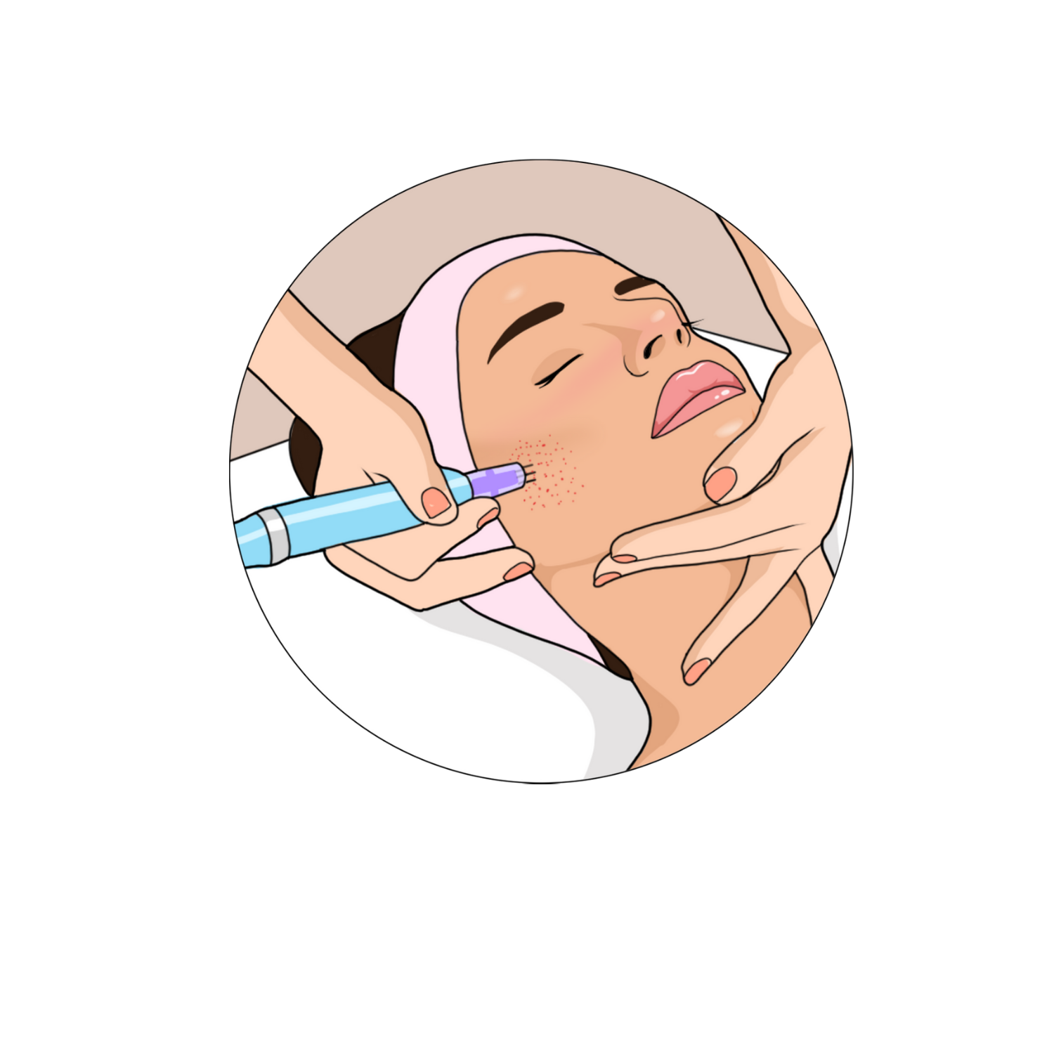 microneedling treatment