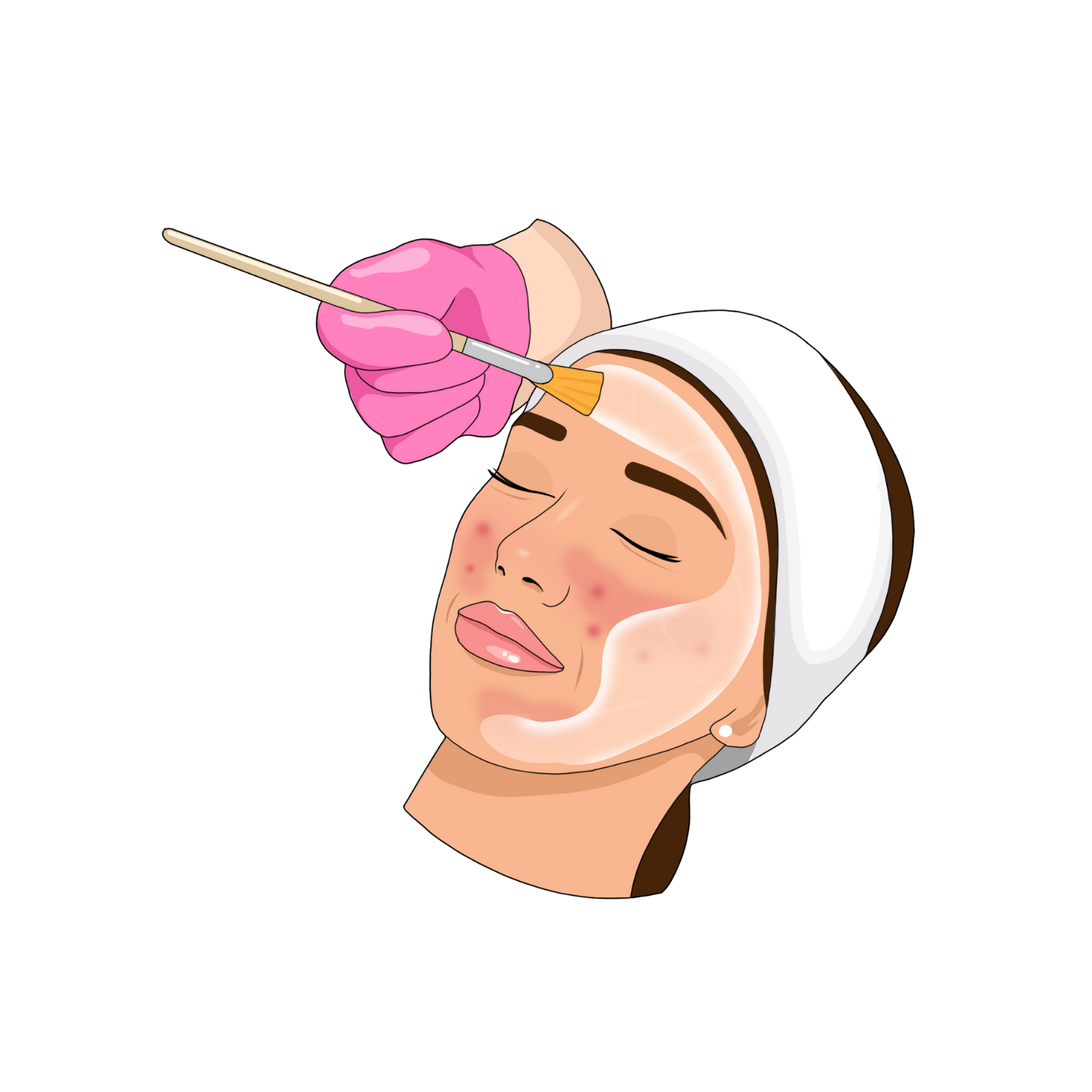 Light Chemical Peels